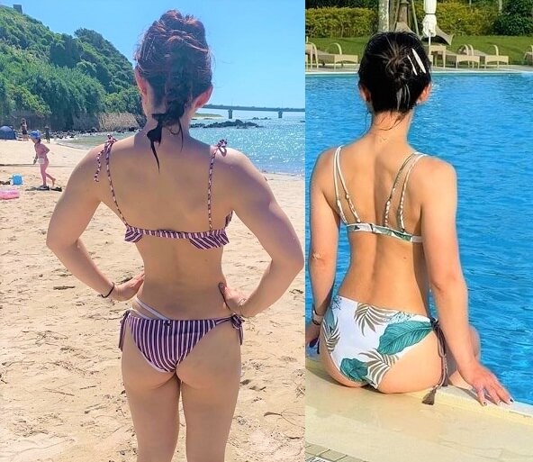 Before After