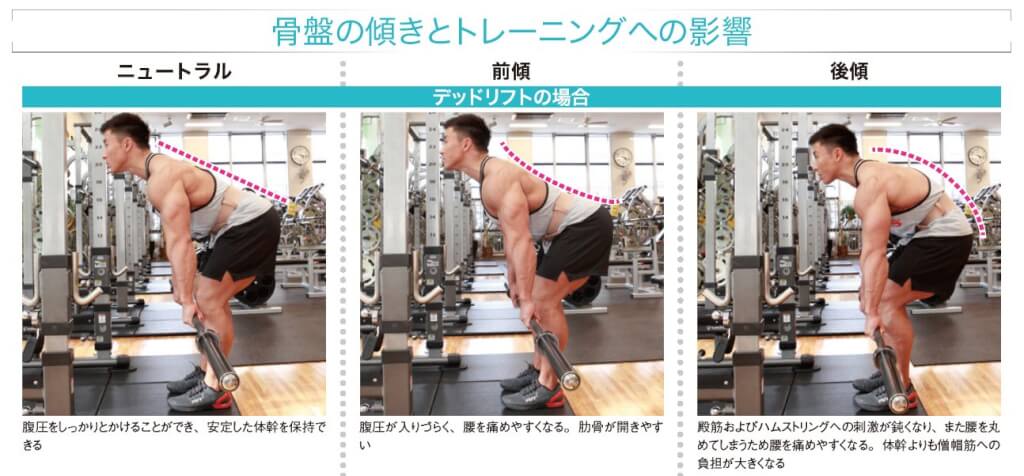 骨盤の傾きとトレーニングへの影響