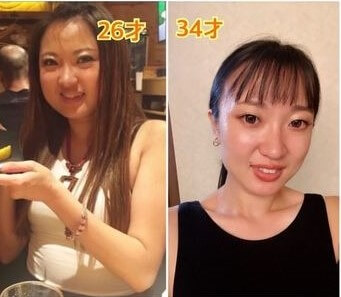 Before After