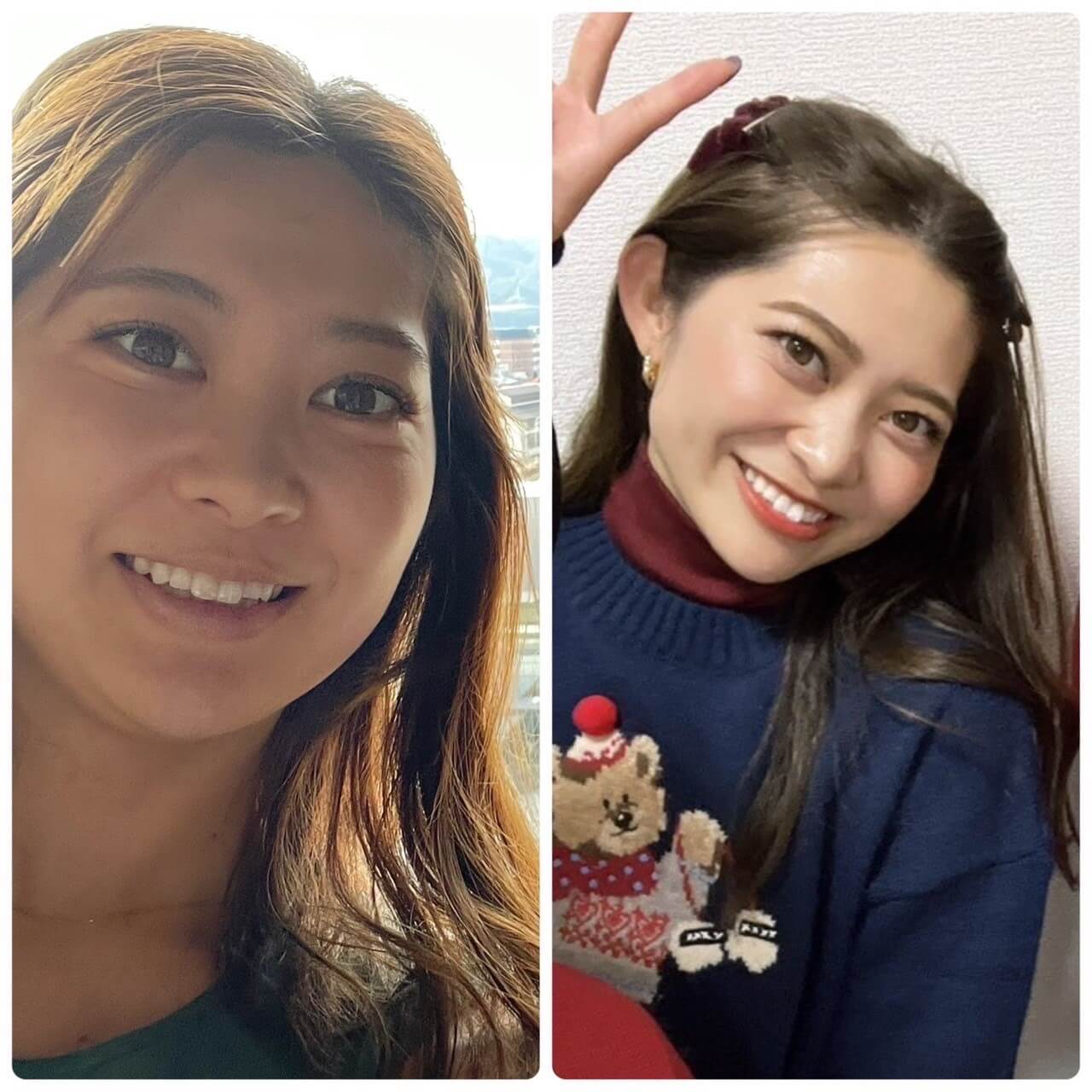 川瀬日奈乃さんのビフォーアフター