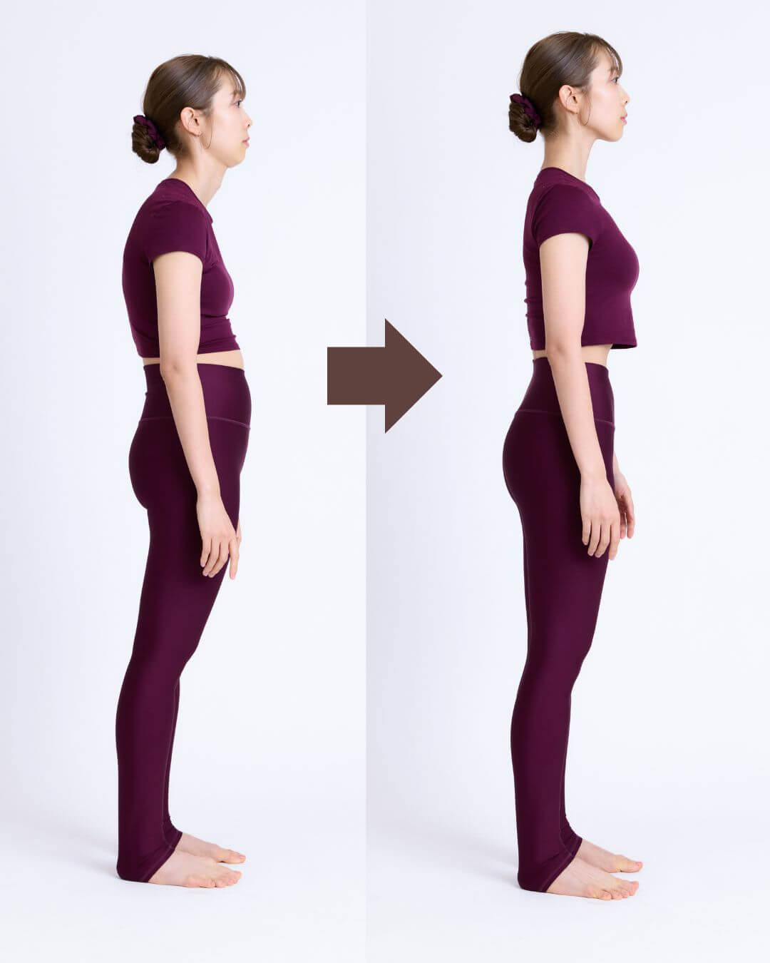 佐川裕香さんの骨格ボディメイクビフォーアフター（横）