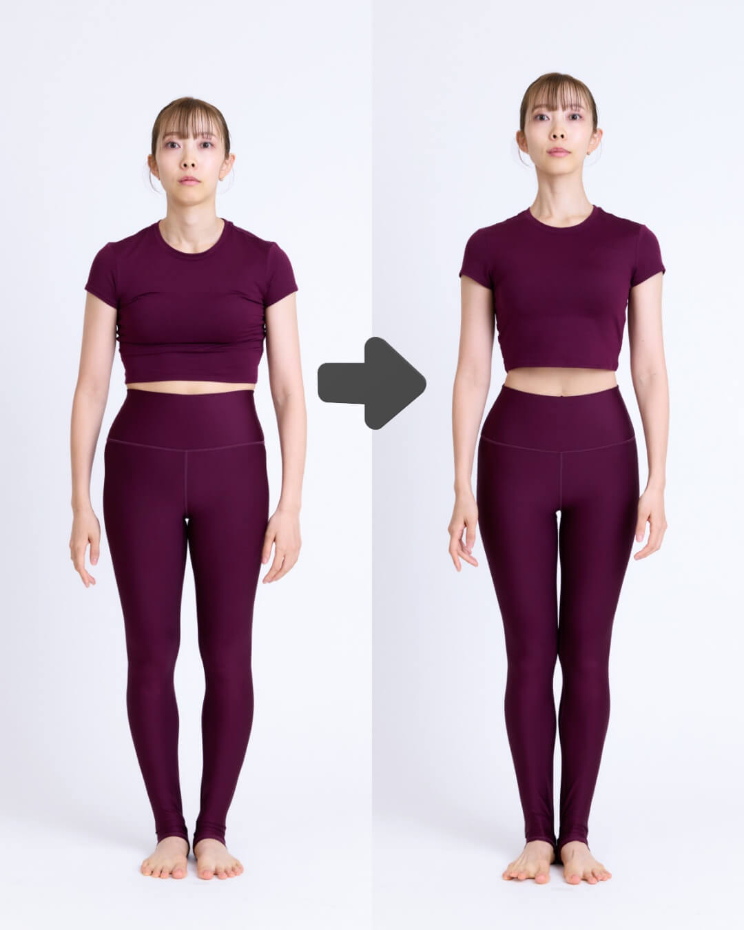 佐川裕香さんの骨格ボディメイクビフォーアフター（正面）