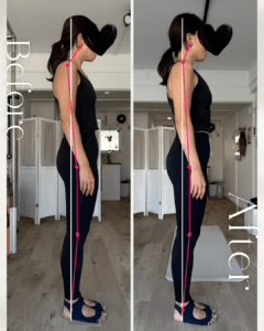 ビフォーアフター