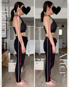 ビフォーアフター