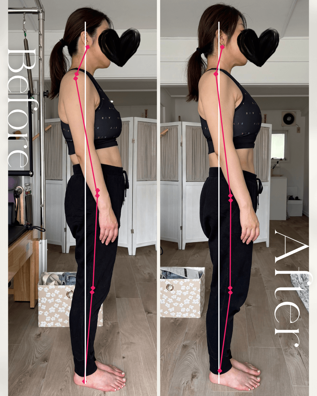 ビフォーアフター