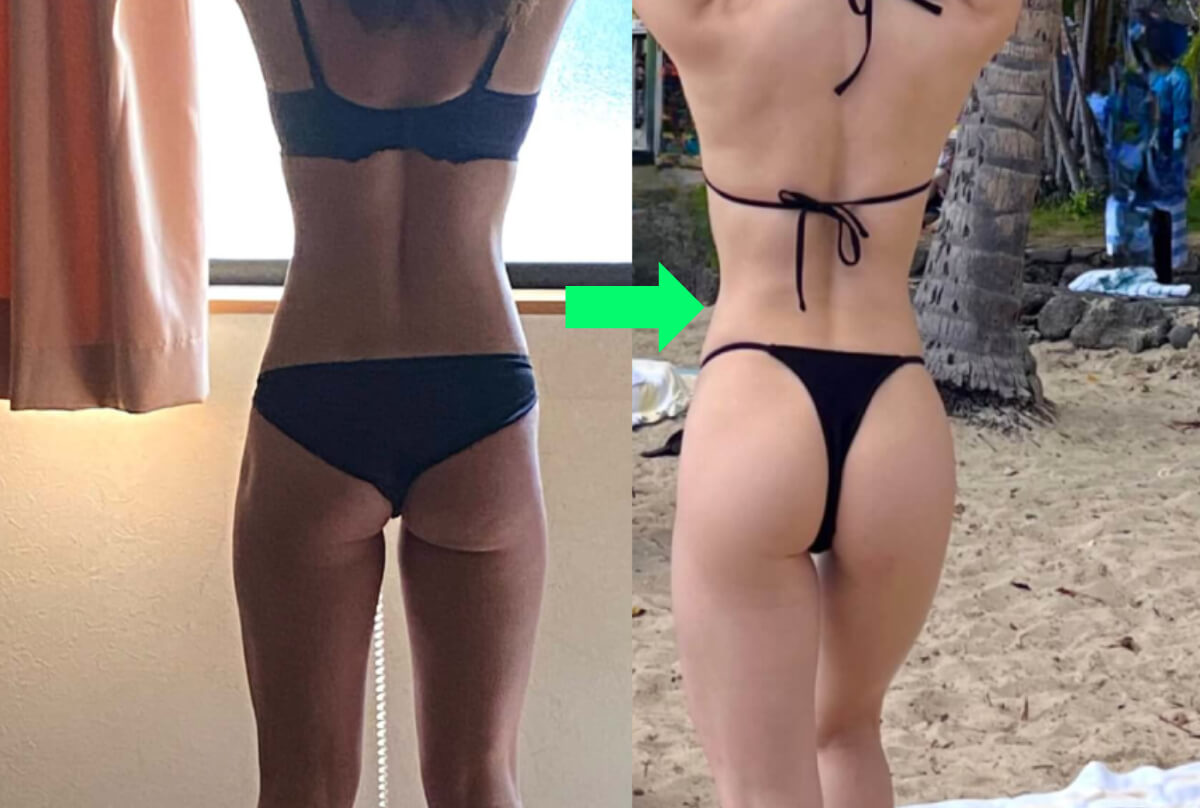 ビフォーアフター